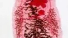 Паразити в людині: соскери